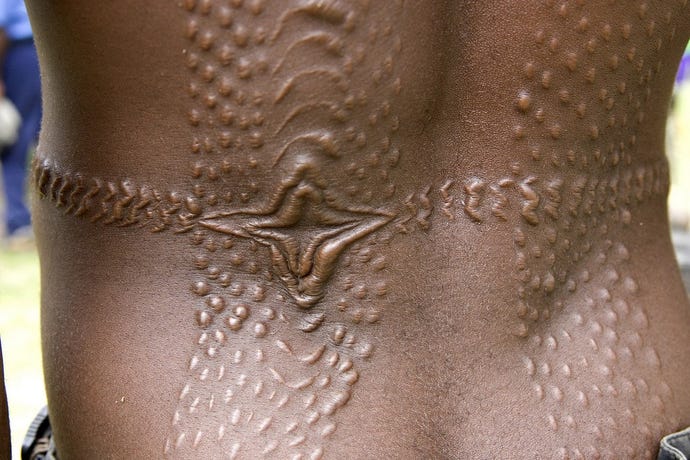 Tribal scarring, practiced by some tribes in the Sepik